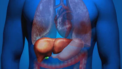 liver 1